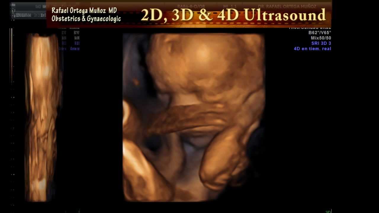 4d pregnancy ultrasound